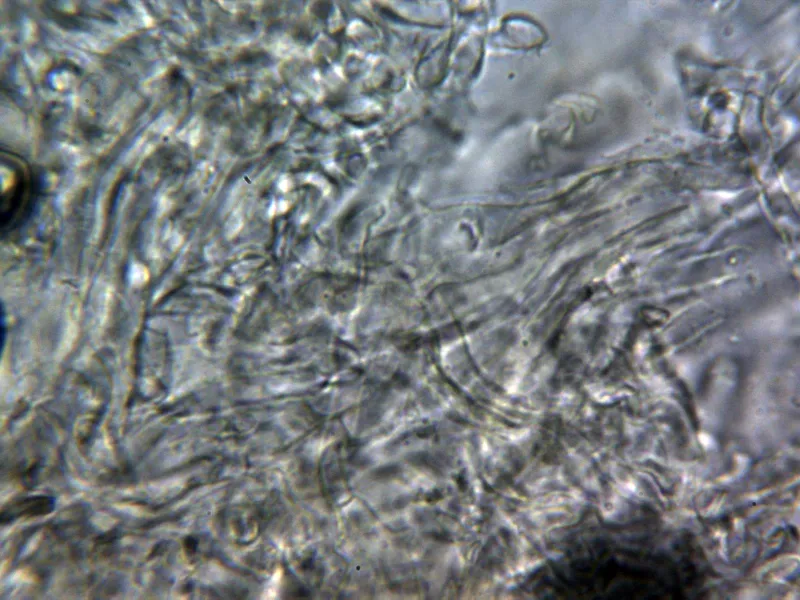 Butyriboletus fechtneri 24 - pileipellis